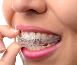 Close-up of woman taking out aligner