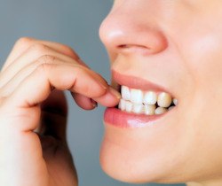 Closeup of patient biting their nails