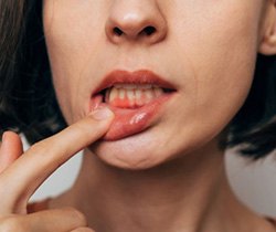 Lady shows off inflamed gums